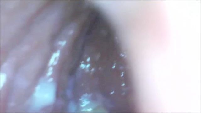 Vaginalexploration Cam Inside